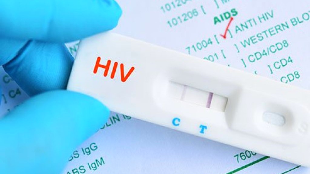 Anti HIV 1/2 Testi