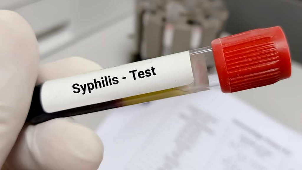 Anti Sifilis Testi