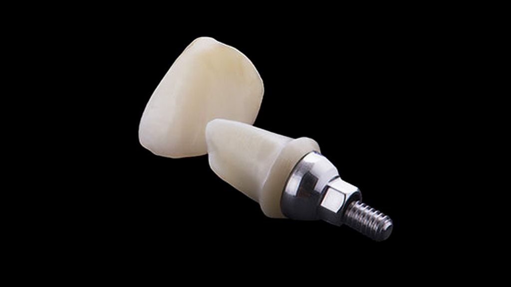 CAD/CAM Abutment