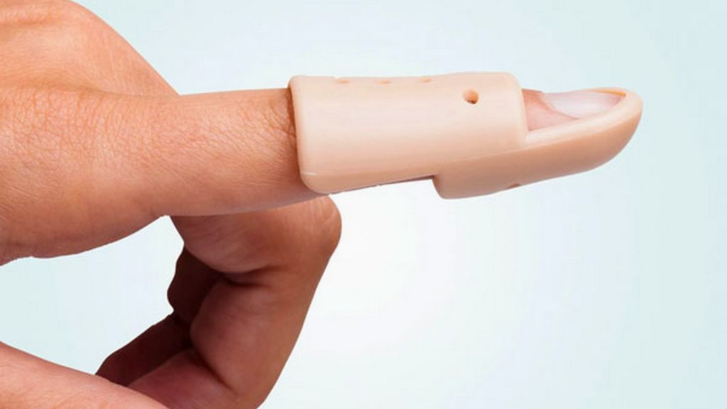 Çekiç Parmak (Mallet Finger) Ateli