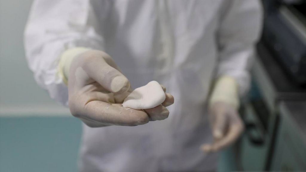 Çimentolu Femoral Sistemler