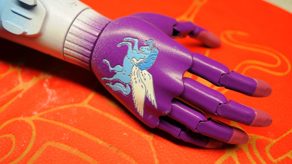 Çocuklar İçin Miyoelektrik Kontrollü Dirsek Altı Protezler