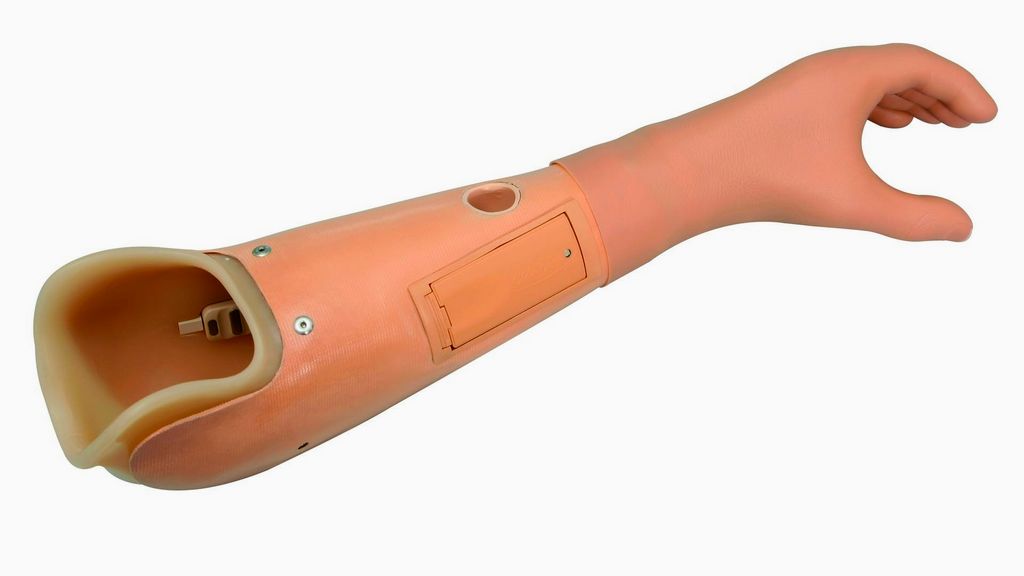 Below Elbow Microprocessor Myoelectric Controlled Prostheses