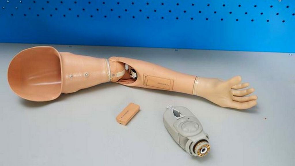 Dirsek Üstü Mikroişlemcili Miyoelektrik Kontrollü Protezler