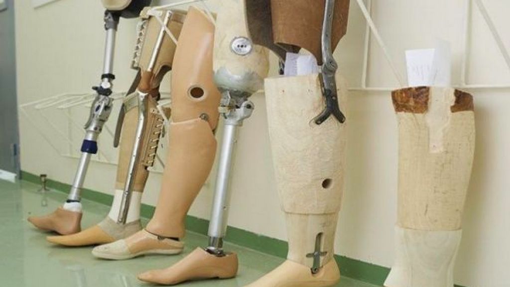 Diz Altı Bacak Protezi - Astar Kilit Sistemsiz Modüler Protez