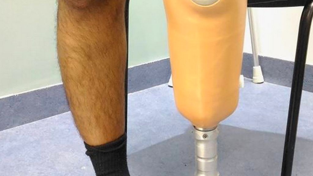 Diz Altı Bacak Protezi - Kişiye Özel Protezler