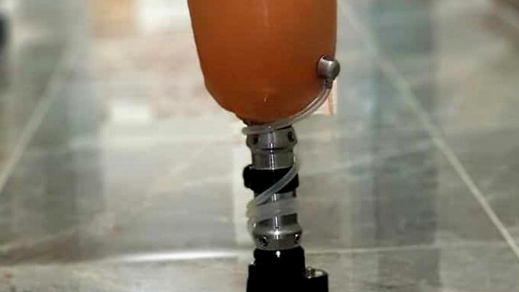 Diz Altı Bacak Protezi - Silikon Astar Kilit Sistemli Modüler Protez