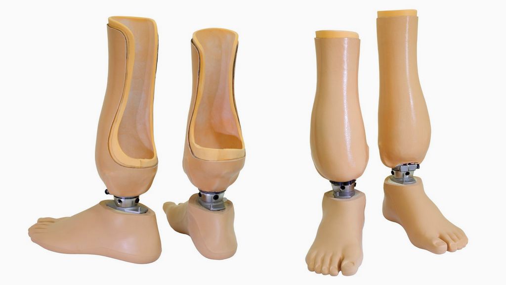 Diz Altı Bacak Protezi - Vakum Sistemli Modüler Protez