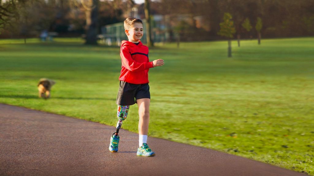 Diz Üstü Bacak Protezi - Çocuklar İçin Protezler