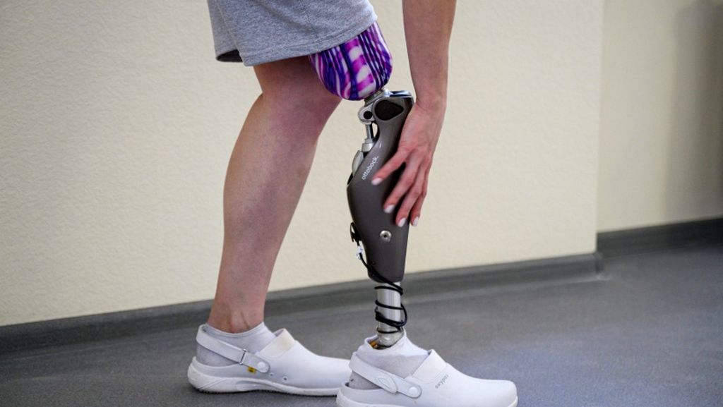 Diz Üstü Bacak Protezi - Hidrolik Protezler