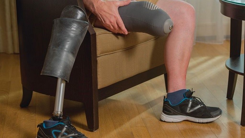 Diz Üstü Bacak Protezi - Klasik Protezler