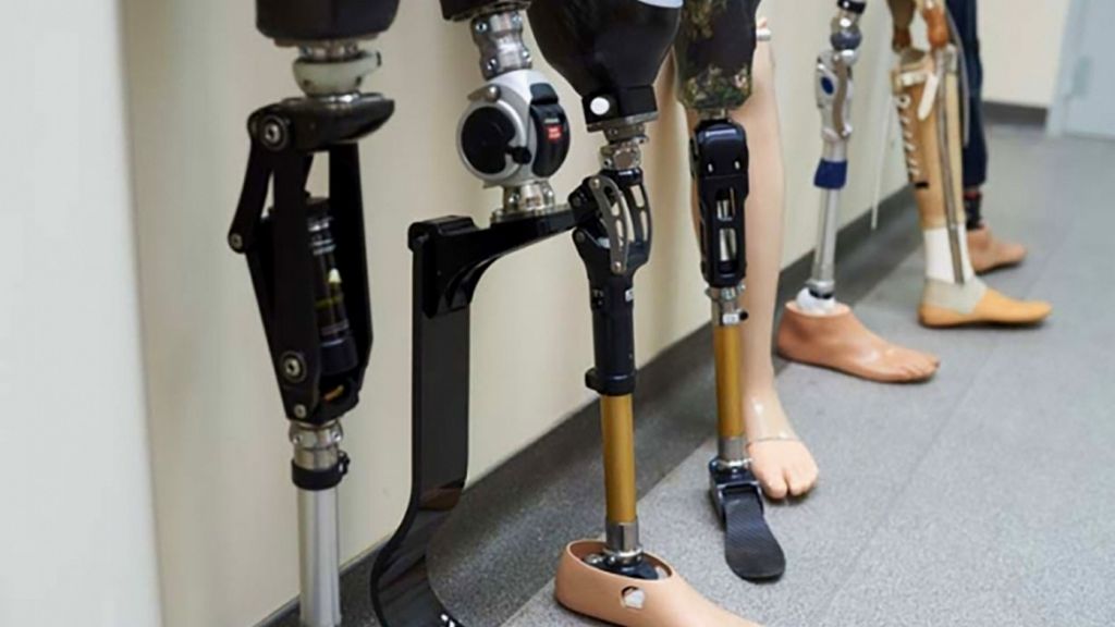Diz Üstü Bacak Protezi - Mekanik Kontrollü Modüler Protezler