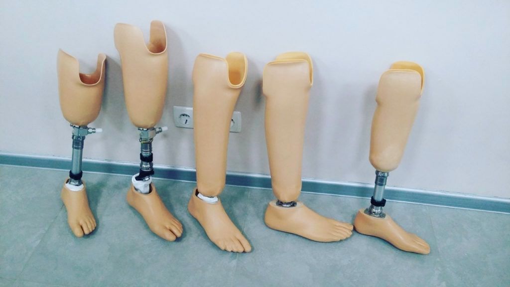 Diz Üstü Bacak Protezi - Modüler Protezler