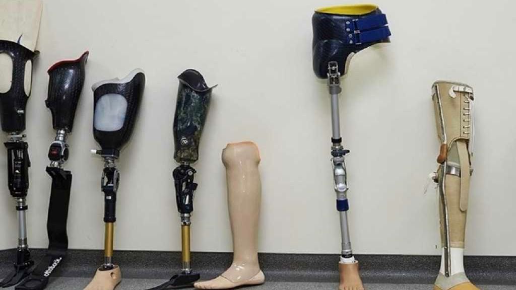Diz Üstü Bacak Protezi - Orto Protezler