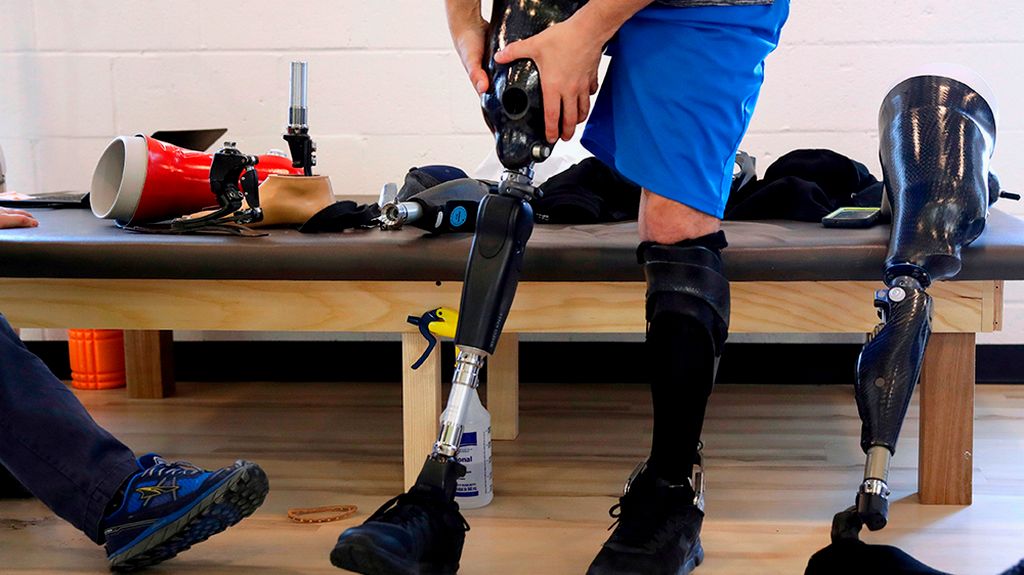 Diz Üstü Bacak Protezi - Pnömatik Protezler