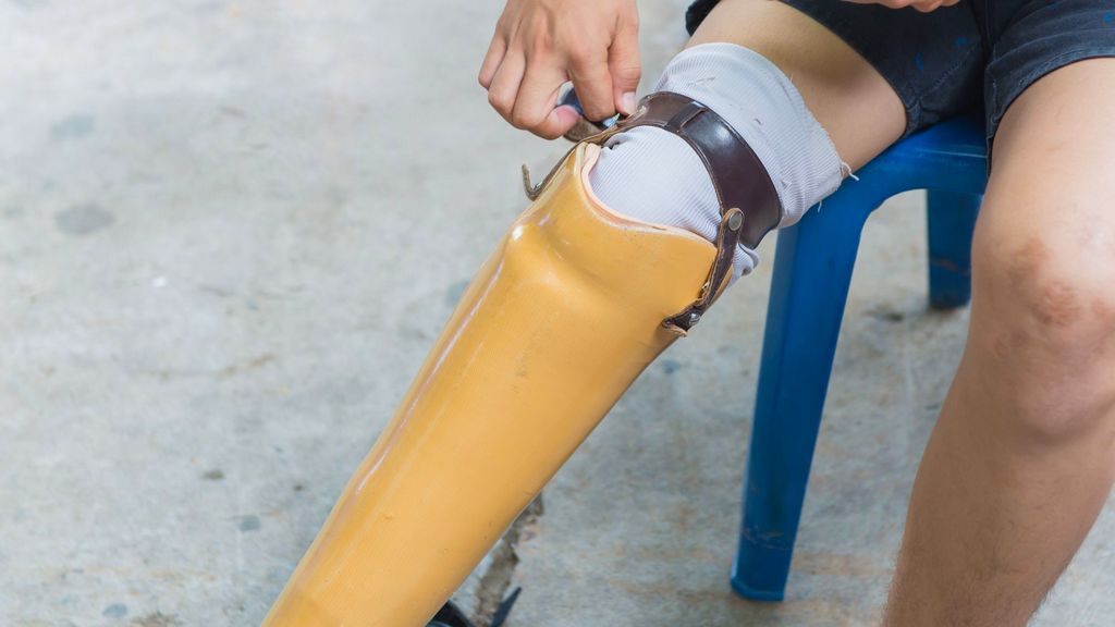 Diz Üstü Bacak Protezi - Polisentrik Protezler