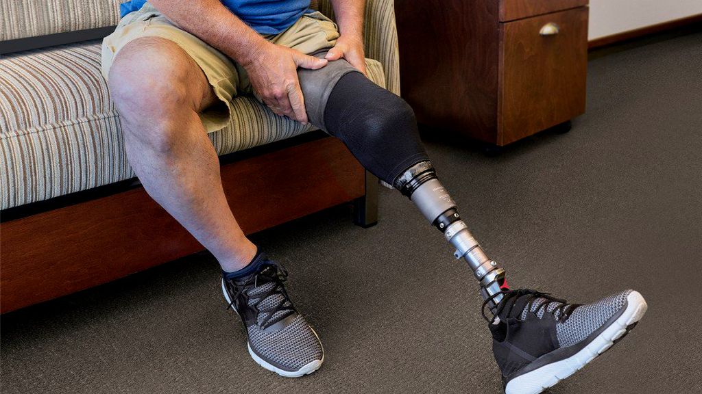 Diz Üstü Bacak Protezi