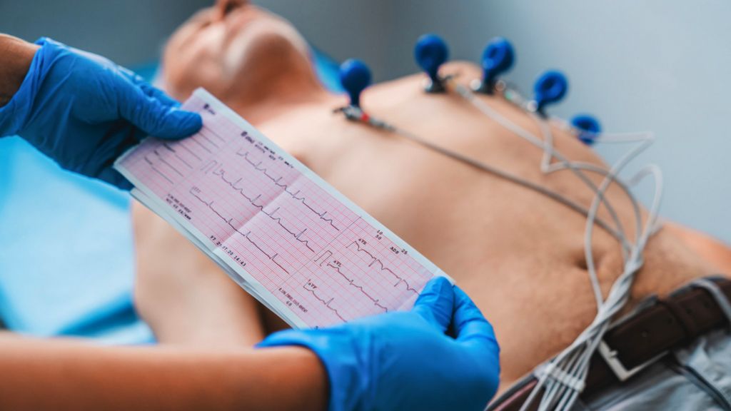 EKG Kağıdı