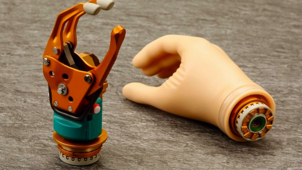 Elektronik Parsiyel El Protezleri