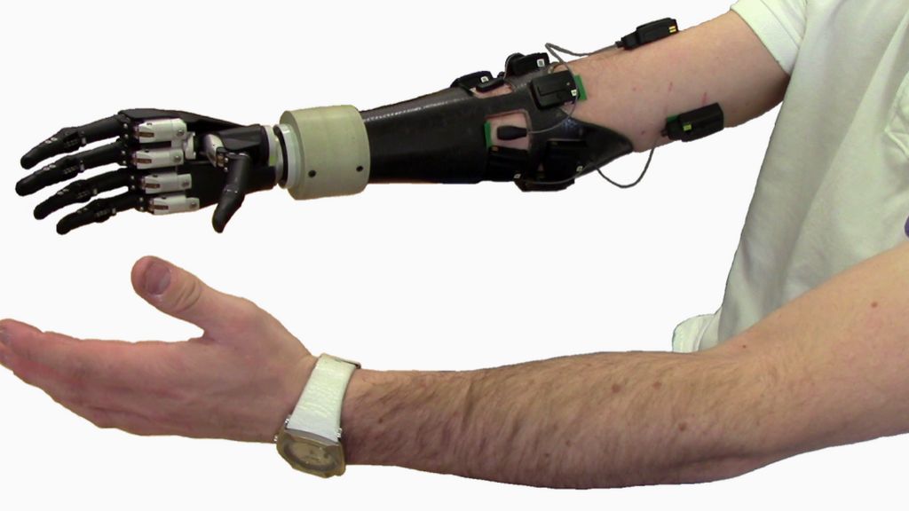 Бионическая рука ilimb. Robotic limbs. Рука робота. Bebionic 3. Robotic limbs.