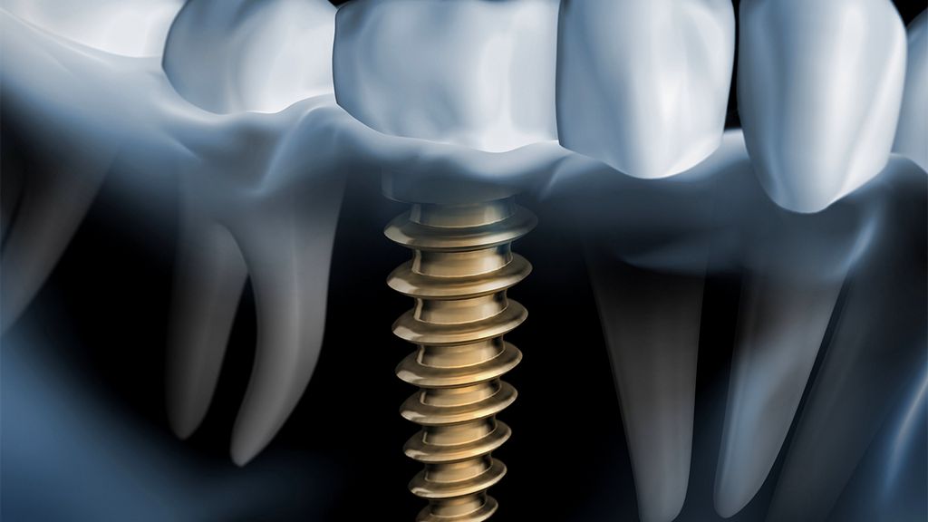 Naberejnye Chelni shahridagi ayollar uchun jinsiy aloqa Trans ayol yigitni sikish videosi