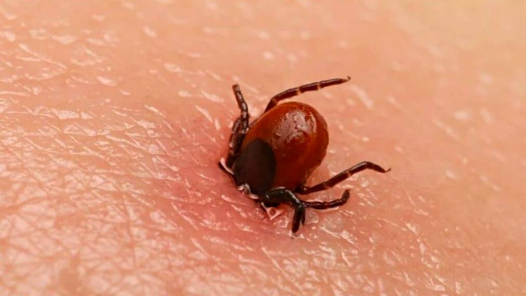 Kene Çıkarma Forsepsi