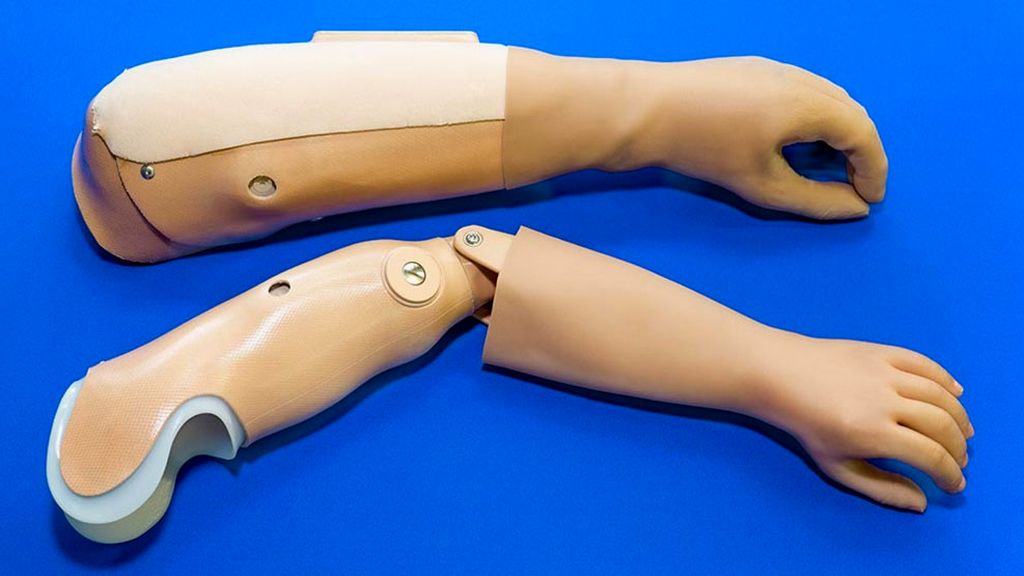 Klasik Dirsek Altı Protezler