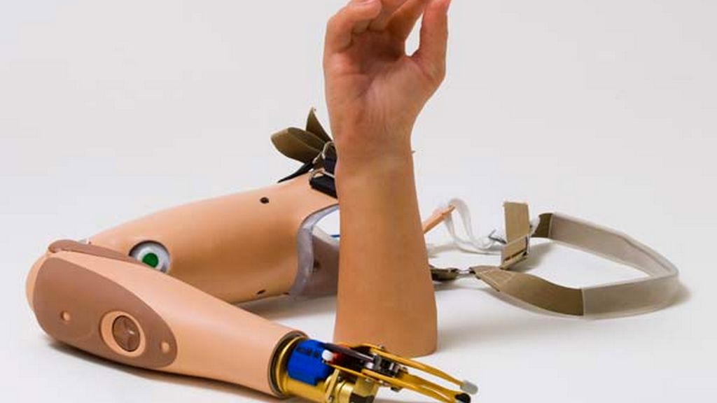 Modüler Dirsek Altı Protezler