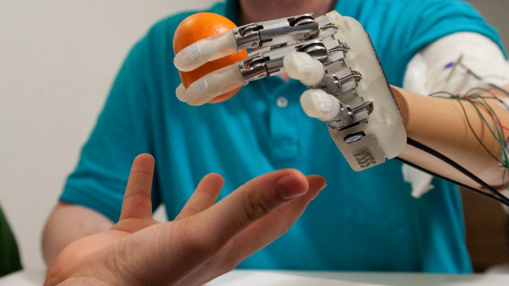 Modüler Dirsek Üstü Protezler