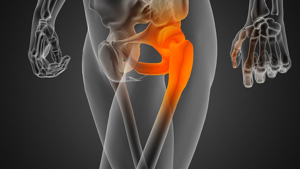 Семіз гейлер