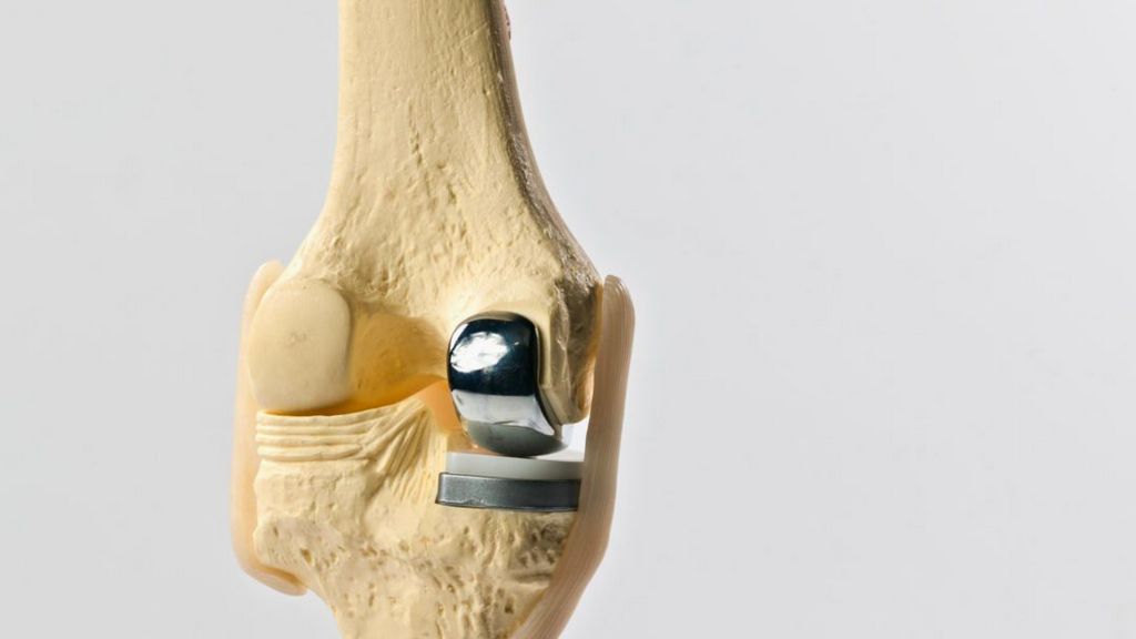 Ortopedi Ürünleri - Diz Protezleri