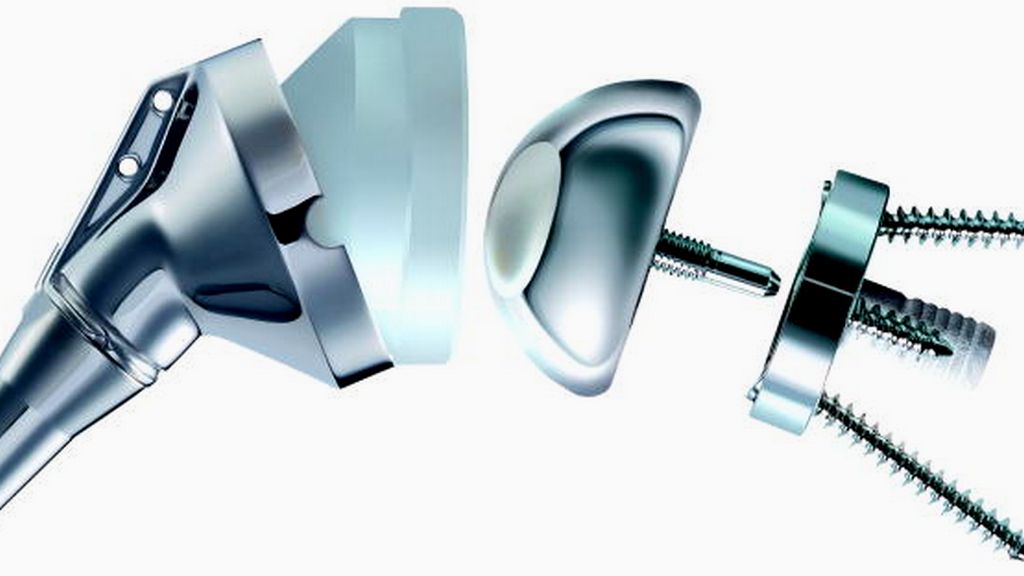 Ortopedi Ürünleri - Omuz Dezartikülasyon Protezleri