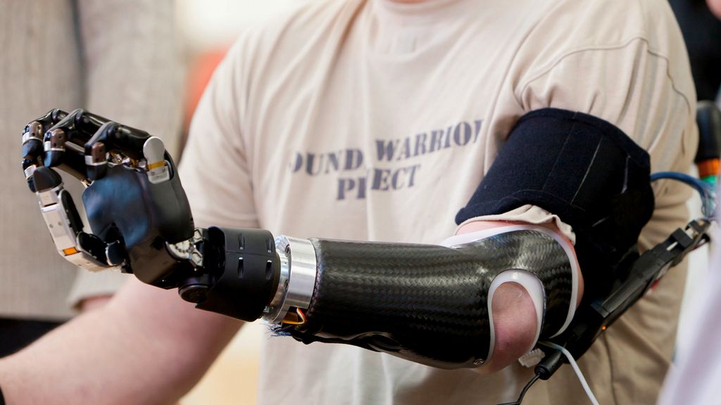 Ortopedi Ürünleri - Parmak ve Parsiyel El Protezleri