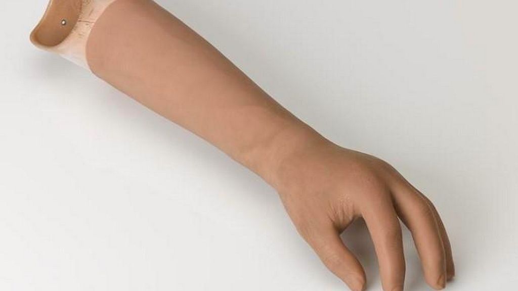 Pasif Dirsek Altı Protezler