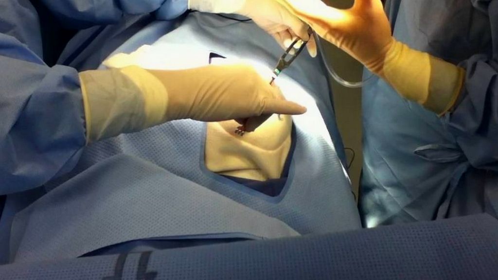 Қынаптық пирсинг