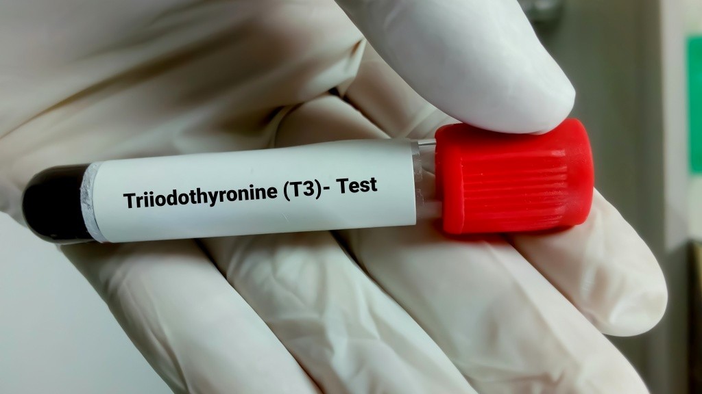 Troponin Testi